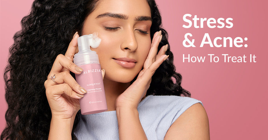 Stress And Acne: How To Treat It