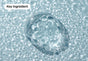 Sodium Hyaluronate
